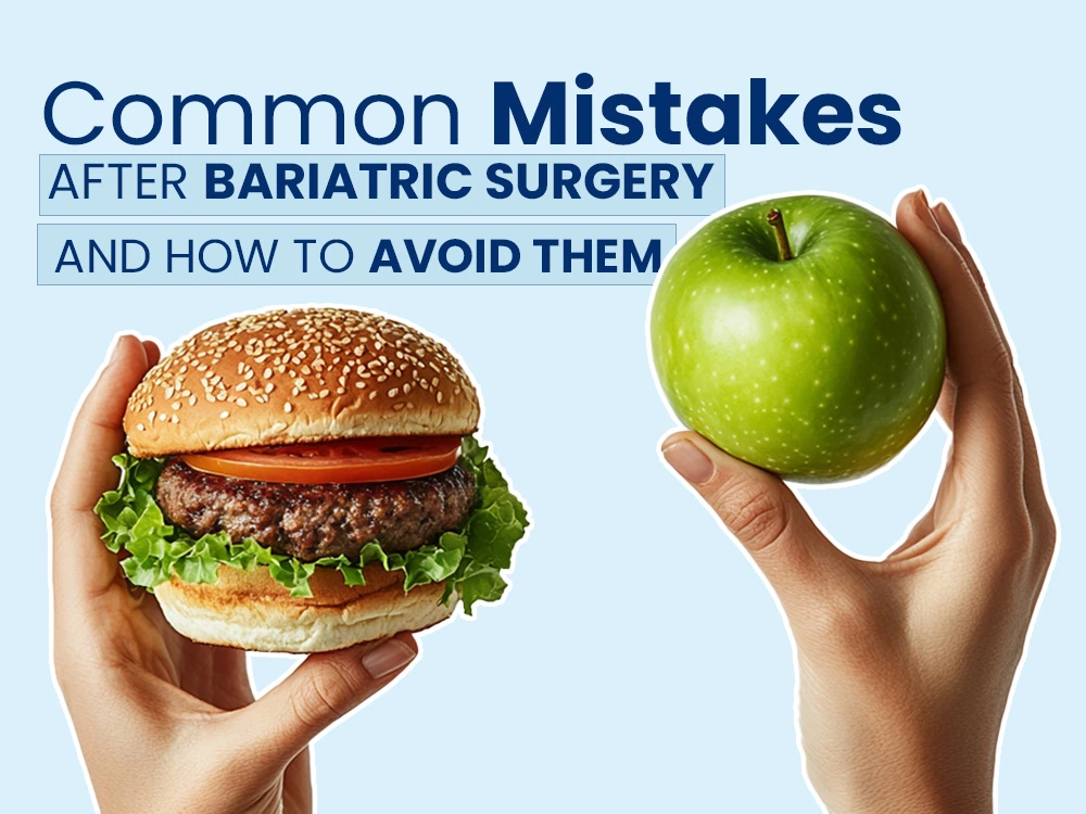 common mistakes after bariatric surgery